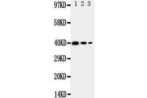 Western Blotting (WB) image for anti-Translocation Associated Membrane Protein 2 (TRAM2) (AA 309-325), (C-Term) antibody (ABIN3044050) (TRAM2 Antikörper  (C-Term))