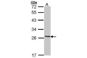 WB Image Sample (30 ug of whole cell lysate) A: Molt-4 , 12% SDS PAGE antibody diluted at 1:1000 (COMT Antikörper)
