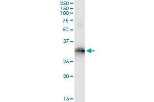 Immunoprecipitation of HOXB9 transfected lysate using anti-HOXB9 monoclonal antibody and Protein A Magnetic Bead , and immunoblotted with HOXB9 MaxPab rabbit polyclonal antibody. (HOXB9 Antikörper  (AA 65-163))
