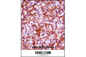 RIPK3 Antibody immunohistochemistry analysis in formalin fixed and paraffin embedded human pancreas tissue followed by peroxidase conjugation of the secondary antibody and DAB staining. (RIPK3 Antikörper  (C-Term))