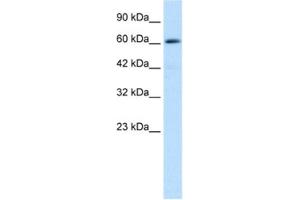 Western Blotting (WB) image for anti-Zinc Finger and BTB Domain Containing 45 (ZBTB45) antibody (ABIN2460149)
