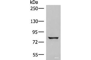Western blot analysis of Human bladder transitional cell carcinoma grade 2-3 tissue lysate using TTC12 Polyclonal Antibody at dilution of 1:300 (TTC12 Antikörper)