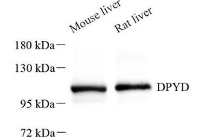Western blot analysis of DPD (ABIN7073735),at dilution of 1: 600 (DPYD Antikörper)