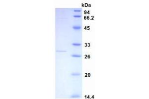 SDS-PAGE analysis of recombinant Human CRP. (CRP Protein)