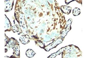 Formalin-fixed, paraffin-embedded human placenta stained with TIMP3 Rabbit PAb. (TIMP3 Antikörper  (AA 175-211))