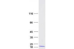 Western Blotting (WB) image for Cathelicidin Antimicrobial Peptide (CAMP) protein (Myc-DYKDDDDK Tag) (ABIN2713103)