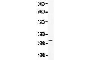 Anti-CNTF Picoband antibody,  All lanes: Anti-CNTF at 0. (CNTF Antikörper  (AA 2-200))