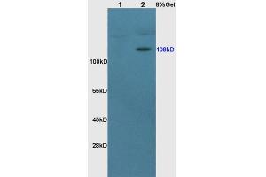 Lane 1: rat brain lysates Lane 2: rat kidney lysates probed with Anti MCR Polyclonal Antibody, Unconjugated  at 1:200 in 4˚C. (NR3C2 Antikörper  (AA 601-700))