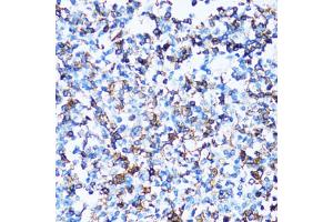 Immunohistochemistry of paraffin-embedded human tonsil using SPN antibody (ABIN2560118) at dilution of 1:100 (40x lens). (CD43 Antikörper)