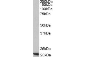 ABIN334401 (1µg/ml) staining of Human Placenta lysate (35µg protein in RIPA buffer). (FTH1 Antikörper  (C-Term))