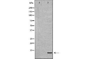 Western blot analysis of extracts of K-562, using S100A8 antibody. (S100A8 Antikörper  (C-Term))