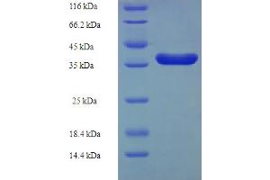 SDS-PAGE (SDS) image for Phycoerythrobilin:ferredoxin Oxidoreductase (PEBB) (AA 1-182), (full length) protein (His-SUMO Tag) (ABIN5711329) (PEBB Protein (AA 1-182, full length) (His-SUMO Tag))