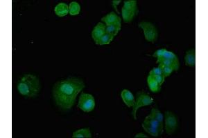 Immunofluorescent analysis of MCF-7 cells using ABIN7156442 at dilution of 1:100 and Alexa Fluor 488-congugated AffiniPure Goat Anti-Rabbit IgG(H+L) (ITGA5 Antikörper  (AA 220-472))