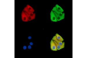 ABIN7096150 and ABIN7100212 staining Hela cells by IF/ICC. (ABRA Antikörper)