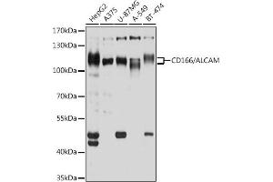 Western blot analysis of extracts of various cell lines, using CD166/CD166/ALCAM antibody (ABIN6127405, ABIN6136759, ABIN6136760 and ABIN6219454) at 1:1000 dilution. (CD166 Antikörper  (AA 28-180))