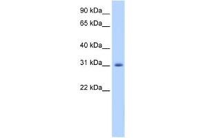 WB Suggested Anti-APOBEC2 Antibody Titration:  1. (APOBEC2 Antikörper  (N-Term))
