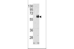 Western blot analysis of TAU(arrow) using rabbit polyclonal TAU Antibody (ABIN388782 and ABIN2839114).