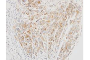 IHC-P Image Immunohistochemical analysis of paraffin-embedded A549 xenograft, using VPS26, antibody at 1:500 dilution. (VPS26A Antikörper  (C-Term))