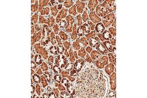 Immunohistochemical analysis of paraffin-embedded human kidney tissue using (ABIN657909 and ABIN2846858) performed on the Leica® BOND RXm.