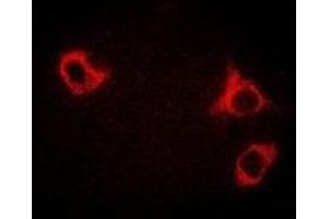 Immunofluorescent analysis of GCN2 staining in HepG2 cells. (GCN2 Antikörper)