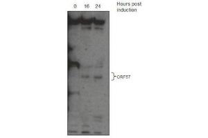 Western Blotting (WB) image for anti-KSHV ORF57 antibody (ABIN2995166) (KSHV ORF57 Antikörper)