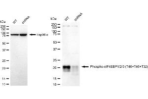 Western blotting analysis using Phospho-eIF4EBP1/2/3 (T46+T46+T32) antibody (ABIN7798429).
