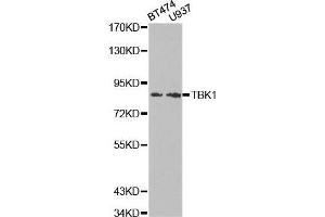 Western blot analysis of extracts of various cell lines, using TBK1 antibody. (TBK1 Antikörper  (AA 440-729))