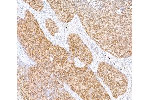 Immunohistochemistry (IHC) image for anti-SMAD Family Member 4 (SMAD4) (AA 1-50) antibody (ABIN7455159)