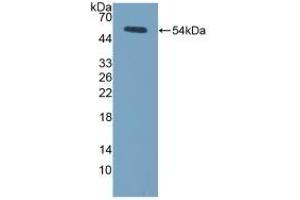 Detection of Recombinant LOX, Mouse using Polyclonal Antibody to Lysyl Oxidase (LOX) (LOX Antikörper  (AA 207-411))