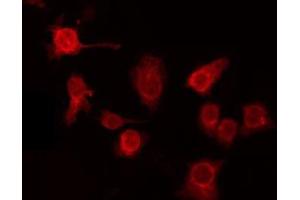ABIN6275995 staining HepG2 by IF/ICC. (GPR137C Antikörper  (Internal Region))