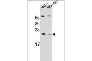 LIN7C Antibody (C-term) (ABIN656734 and ABIN2845958) western blot analysis in MCF-7,NCI- cell line lysates (35 μg/lane). (LIN7C Antikörper  (C-Term))