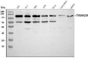 Western blot analysis of KAP1 using anti-KAP1 antibody (ABIN3043491).