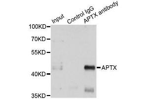 Immunoprecipitation analysis of 150ug extracts of A549 cells using 3ug APTX antibody.