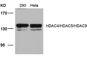 Western blot analysis of extracts from 293 and Hela cells using HDAC4/HDAC5/HDAC9(Ab-246/259/220) Antibody. (HDAC4/HDAC5/HDAC9 Antikörper)