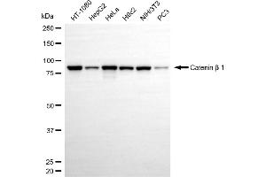 Western blotting analysis using catenin beta 1 antibody (ABIN7797925).