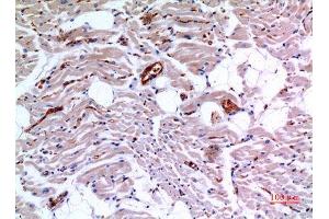 Immunohistochemistry (IHC) analysis of paraffin-embedded Human Heart, antibody was diluted at 1:100. (IDH3A Antikörper  (Internal Region))