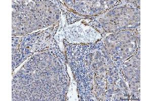 IHC analysis of TP53I13 using anti-TP53I13 antibody (ABIN7601220). (TP53I13 Antikörper  (AA 30-365))