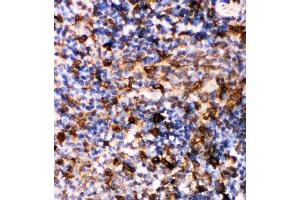 Immunohistochemistry (IHC) image for anti-Caspase 6, Apoptosis-Related Cysteine Peptidase (CASP6) (AA 24-44), (N-Term) antibody (ABIN3043219)