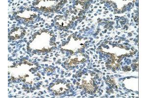 Image no. 1 for anti-Placental Alkaline Phosphatase (ALPP) (AA 411-460) antibody (ABIN203490) (PLAP Antikörper  (AA 411-460))