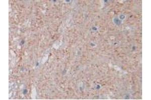IHC-P analysis of Rat Spinal Cord Tissue, with DAB staining.