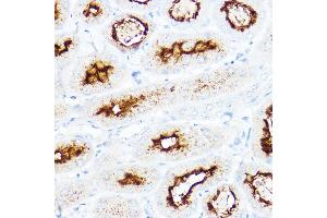 Immunohistochemistry of paraffin-embedded mouse kidney using SLC3 Rabbit pAb (ABIN6132663, ABIN6147998, ABIN6147999 and ABIN6221169) at dilution of 1:200 (40x lens).