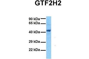 Host:  Rabbit  Target Name:  GTF2H2  Sample Tissue:  Human 293T  Antibody Dilution:  1. (GTF2H2 Antikörper  (Middle Region))