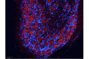 Image no. 1 for Rabbit anti-Mouse IgG antibody (Atto 550) (ABIN1102330) (Kaninchen anti-Maus IgG Antikörper (Atto 550))