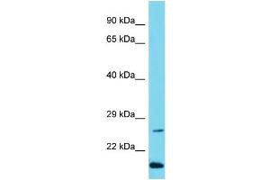 Host: Rabbit Target Name: C10orf95 Sample Type: Jurkat Whole Cell lysates Antibody Dilution: 1. (C10ORF95 Antikörper  (N-Term))