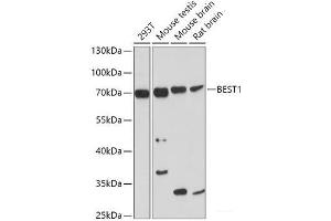 Western blot analysis of extracts of various cell lines using BEST1 Polyclonal Antibody at dilution of 1:1000. (Bestrophin 1 Antikörper)