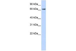DLG3 antibody used at 1 ug/ml to detect target protein. (DLG3 Antikörper)
