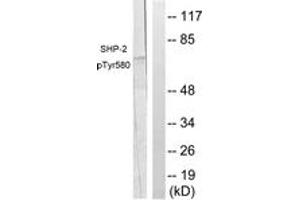 Western blot analysis of extracts from A431 cells, using SHP-2 (Phospho-Tyr580) Antibody.