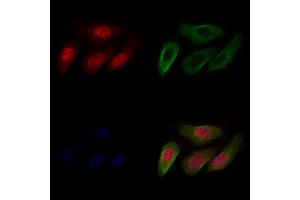 ABIN6265350 and ABIN6266871 staining Hela cells by IF/ICC. (STRADA Antikörper  (Internal Region))