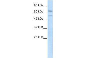 WB Suggested Anti-ZNF306 Antibody Titration:  0. (ZKSCAN3 Antikörper  (N-Term))
