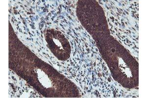Immunohistochemical staining of paraffin-embedded Human endometrium tissue using anti-RUVBL2 mouse monoclonal antibody. (RUVBL2 Antikörper  (AA 113-370))